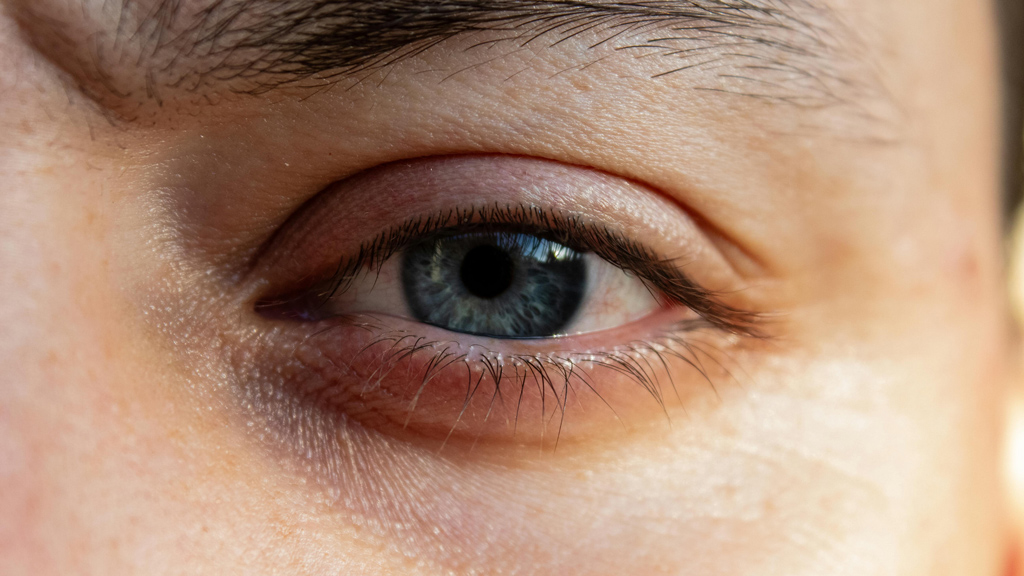 What Causes Dark Circles And How To Reduce Them
