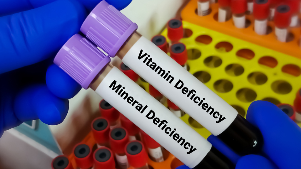 Common Nutrient Deficiencies and How to Avoid Them
