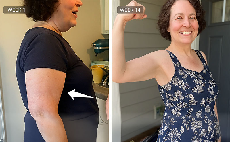 7 Reasons Why Even Celebrities Are Ditching Invasive Surgeries and Choosing This Sculpting Device Instead